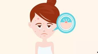 拨粉刺视频,拨粉刺视频教学